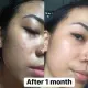 [HCM]Kem chấm mụn cấp tốc ngừa mụn T-Zone Spot Zapping Gel 8ml. 