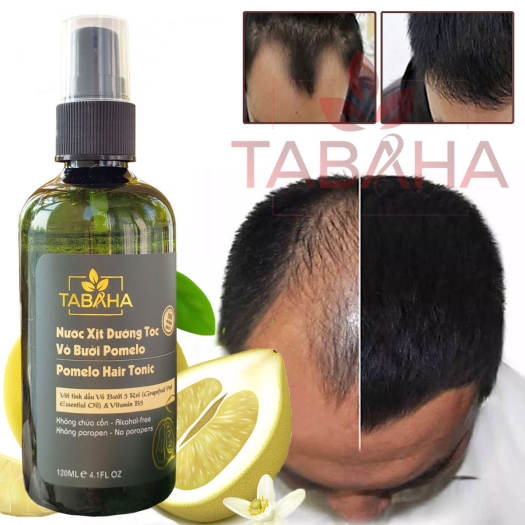 Tinh dầu bưởi xịt mọc tóc cho Nam Tabaha 120ml giúp kích thích mọc tóc con  giảm rụng tóc hói tóc - Sản phẩm chăm sóc tóc 