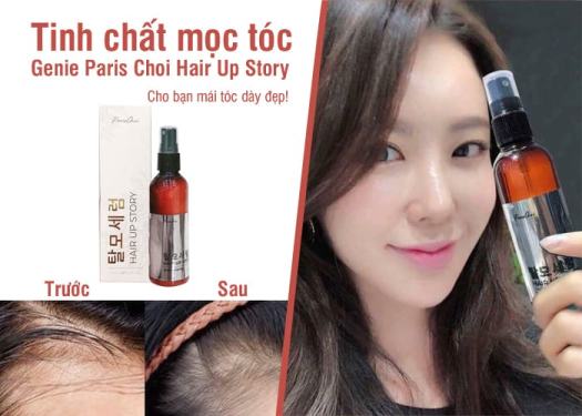 Serum Xịt Kích Mọc Tóc, Ngừa Rụng Tóc Hair Up Story Hàn Quốc - Sản ...