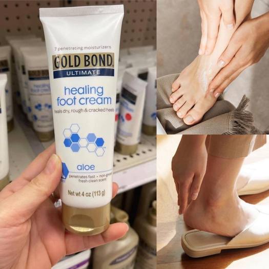 Kem chân Gold Bond Ultimate Healing 
