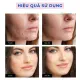 Miếng dán mụn gom cồi sử dụng ngày và đêm bảo vệ mụn kiểm soát dầu giảm sưng đỏ gồm 24 miếng nhiều kích cỡ CN053.00. 